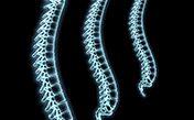 spine xrays