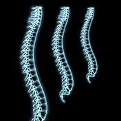 spine X-rays