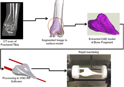 Rapid Machining of Bone Fragments